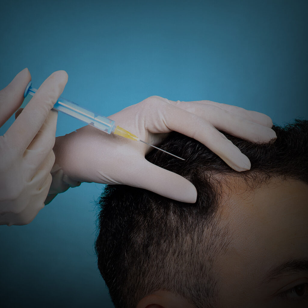 Hair Transplant